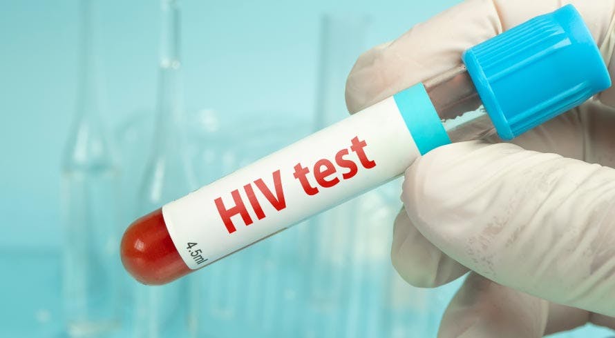 Novo Tratamento para HIV Apresenta Resultados Surpreendentes